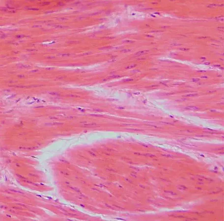 Smooth muscle cells